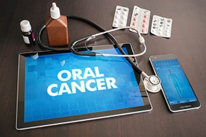 VelScope Oral Cancer Screening